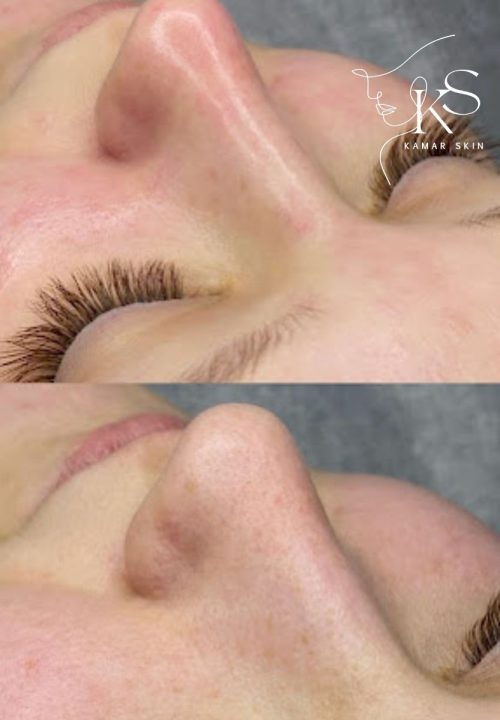 Gesichtsbehandlung Kamar Skin Wuppertal