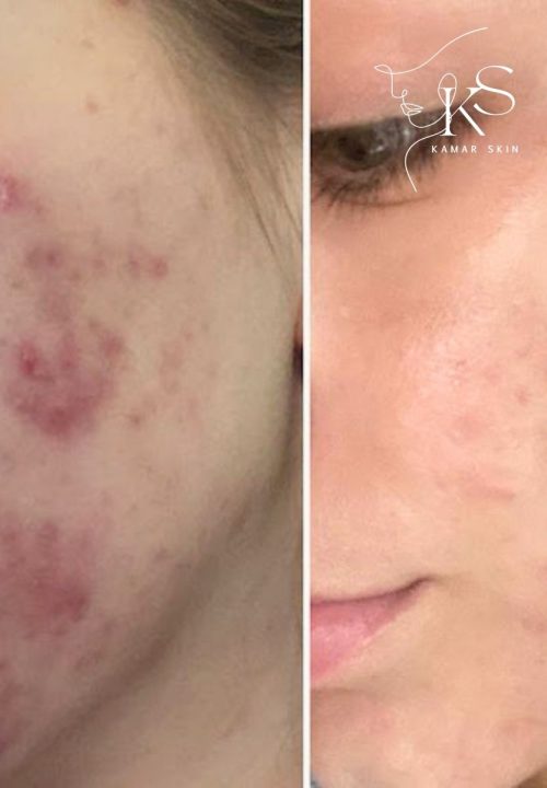 Gesichtsbehandlung Kamar Skin Wuppertal