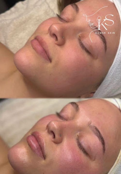 Gesichtsbehandlung Kamar Skin Wuppertal
